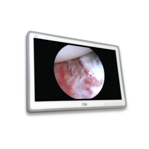 FSN Surgical Monitor