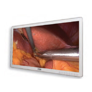 FSN Surgical Monitor