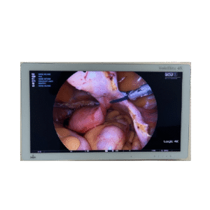 Surgical Monitors