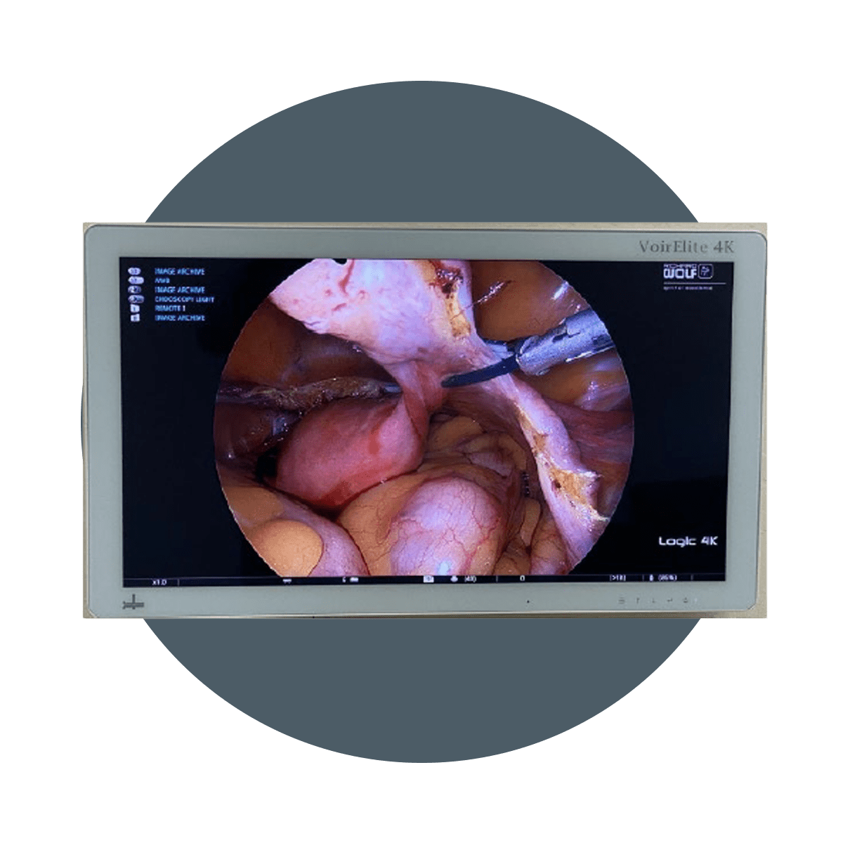 Hipac Digital Operating Room - Monitors