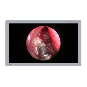 VoirElite Surgical Monitor