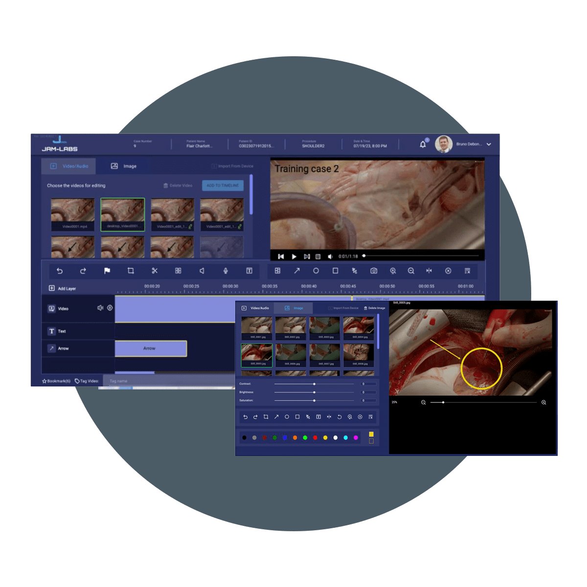 Hipac Digital Operating Room - Media Management