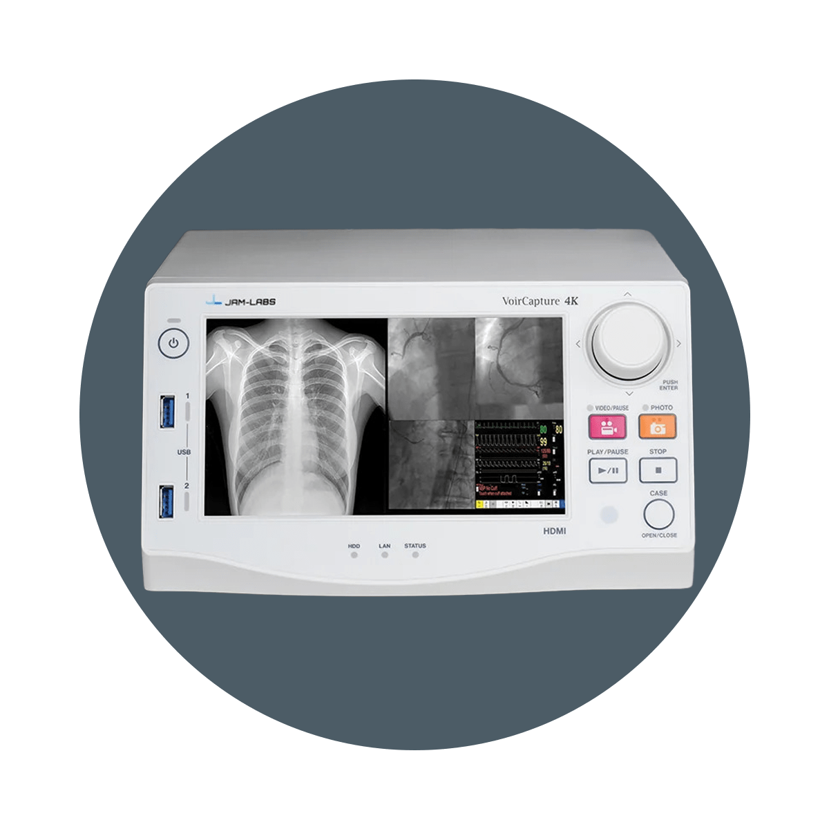 Hipac Digital Operating Room - Surgical Media Recorders